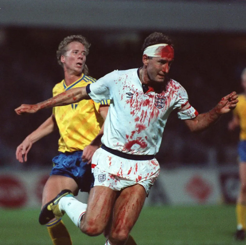 terry butcher playing for england while injured