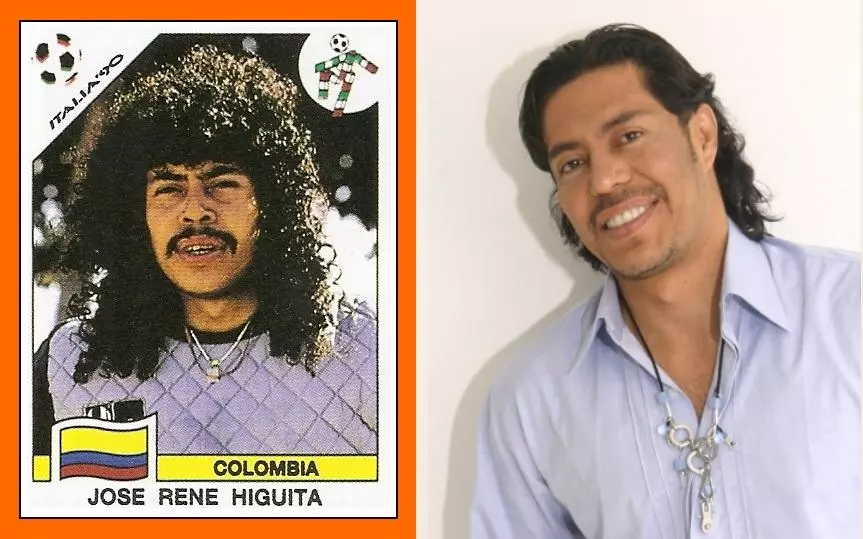 Rene Higuita plastic surgery change